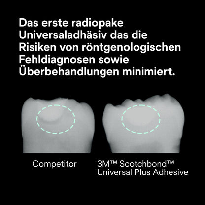 Scotchbond Universal Plus Adhäsiv Introkit