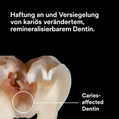 Scotchbond Universal Plus Adhäsiv Flasche 5 ml