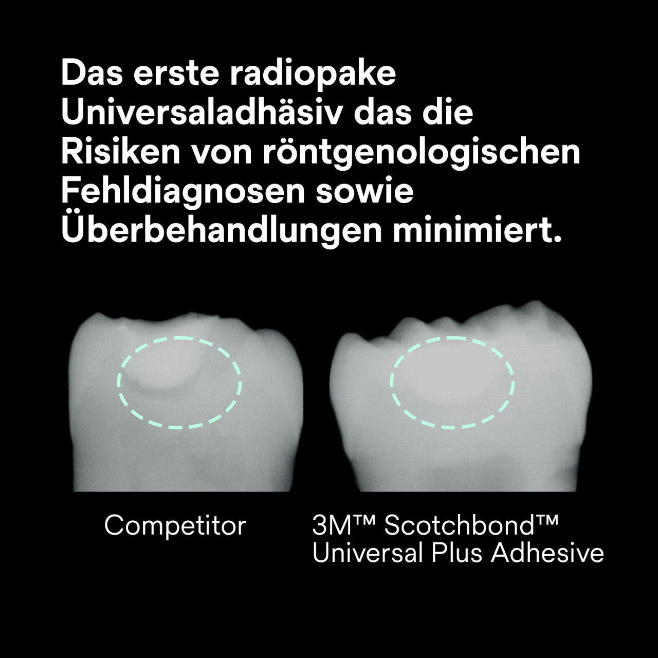 Scotchbond Universal Plus Adhäsiv Flasche 5 ml