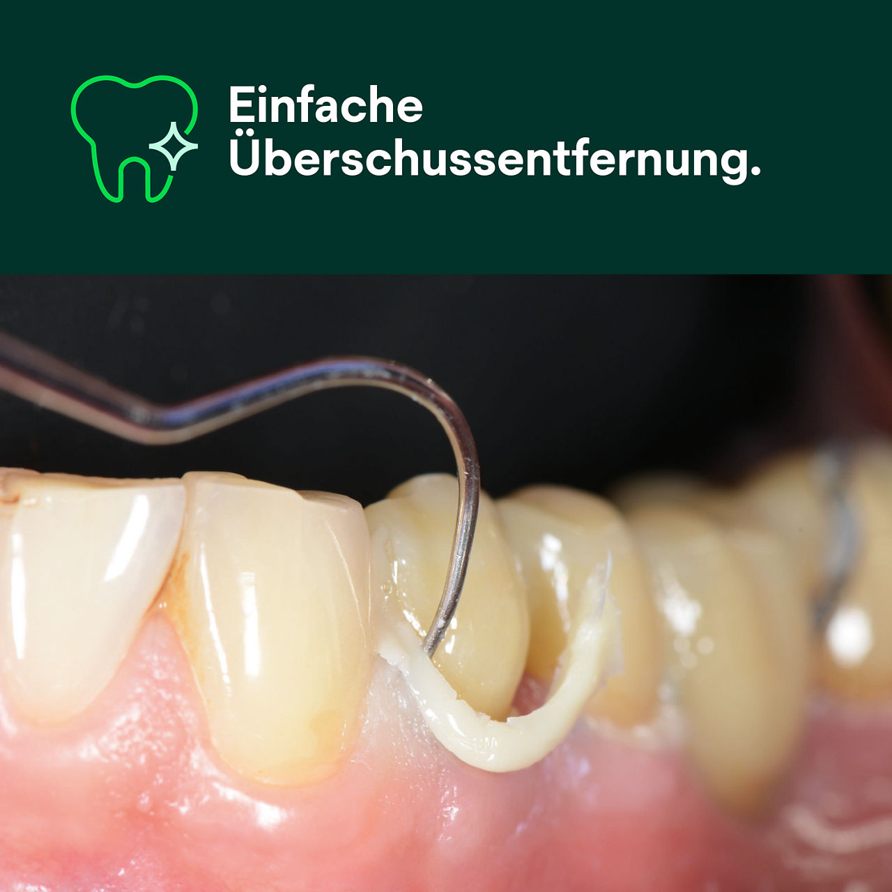 RelyX Universal Resin Cement Transluzent Spritze 3,4g