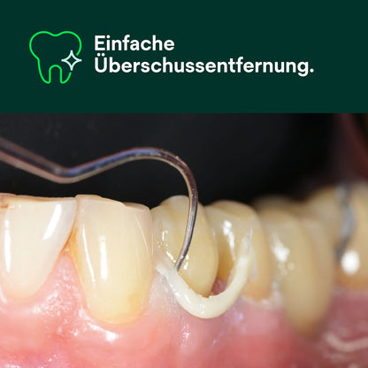 RelyX Universal Resin Cement WO Spritze 3,4g