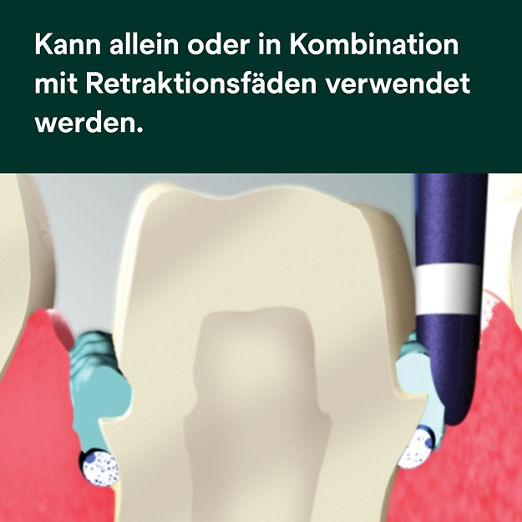 Astringierende Retraktionspaste Pa 25